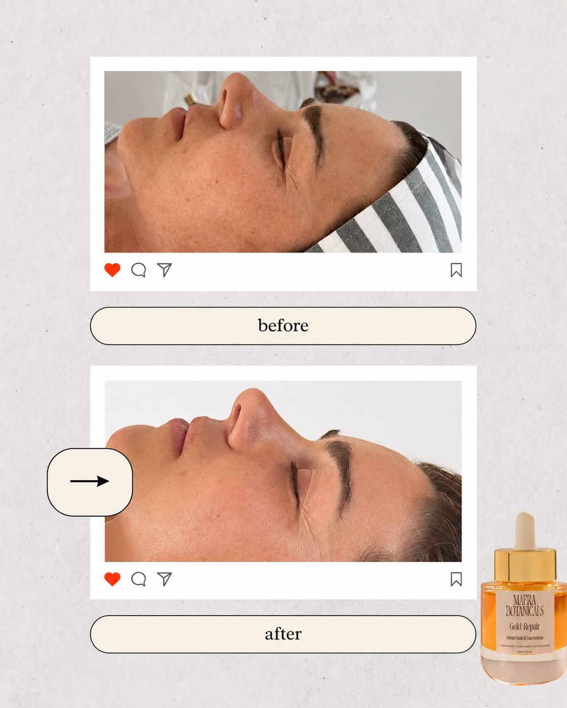 Gold Repair - Sérum Facial